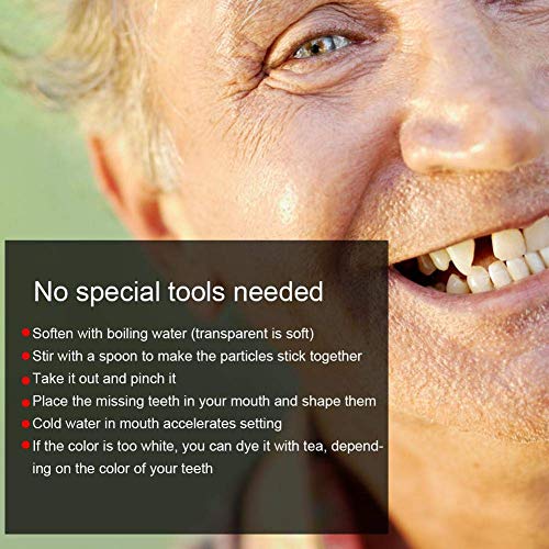 Temporary Broken Teeth Repair Kit