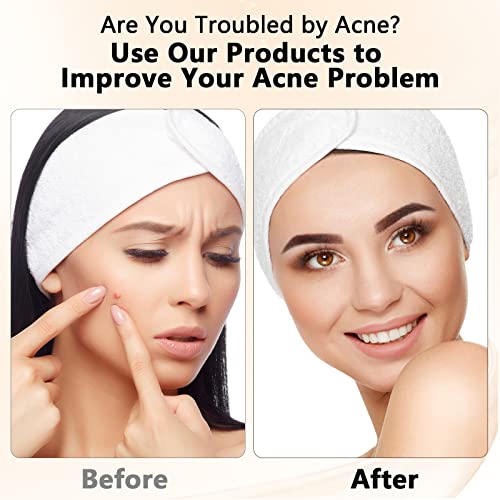 TAYTHI Blackhead Remover Tool, Pimple Popper Tool Kit, Blackhead Extractor to...