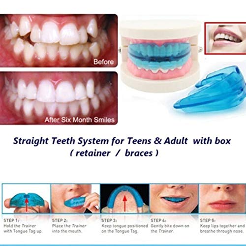 Dental Mouth Guard Bruxism TMJ Night Teeth Tooth Grinding Sleep Aid for Starters