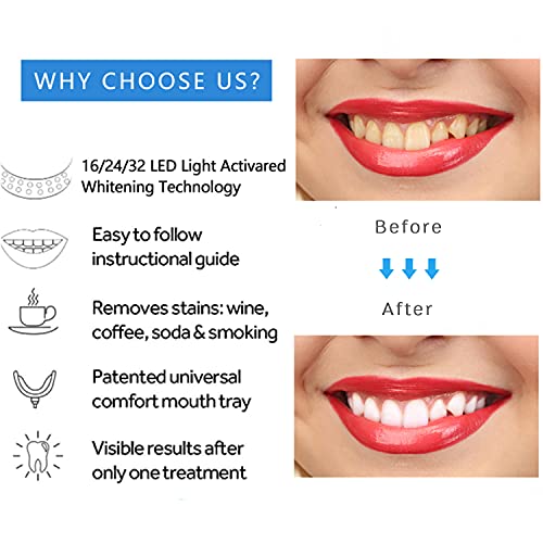 Teeth Whitening Kit, Teeth Whitening Gel with LED Accelerator Light and Tray ...