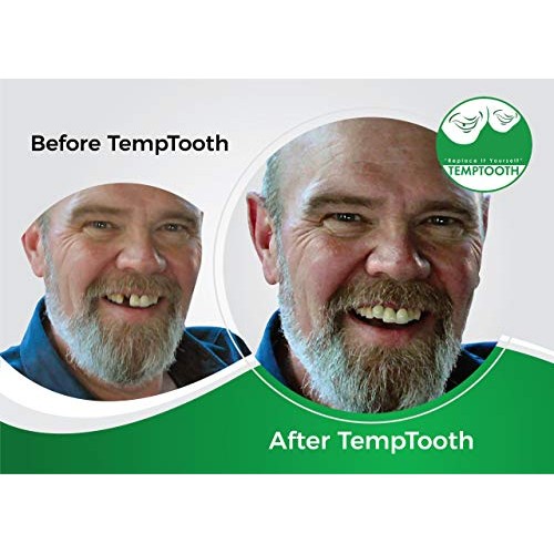 Temptooth #1 Seller Trusted Patented Temporary Tooth Replacement Product