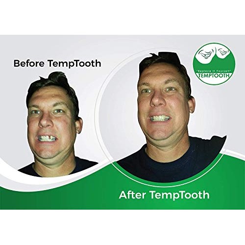 Temptooth #1 Seller Trusted Patented Temporary Tooth Replacement Product