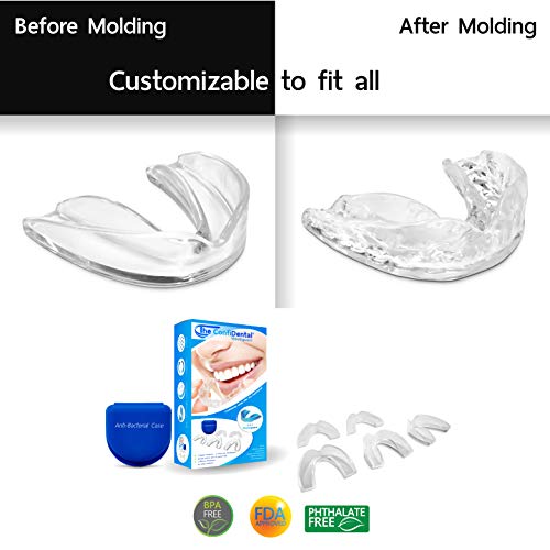 The ConfiDental - Pack of 5 Moldable Mouth Guard for Teeth Grinding Clenching...