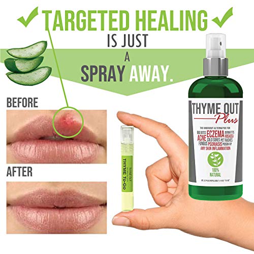 Thyme Out Plus Eczema Treatment, Psoriasis Treatment Treats Acne, Dermatitis,...