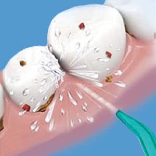 Water Flosser Portable Oral Irrigator Travel Water Jet Cordness Dental SPA De...