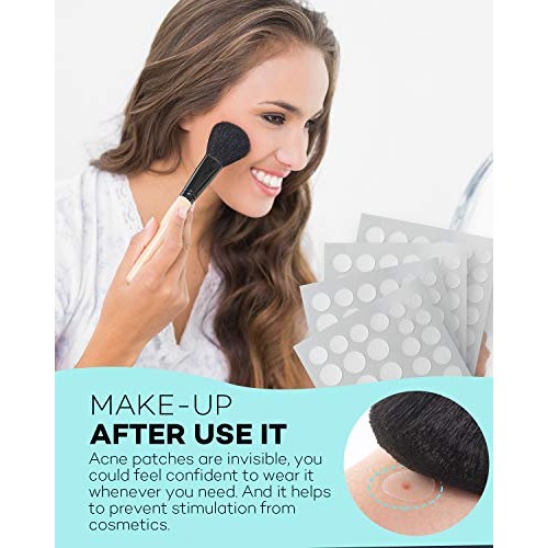 Acne Patch Pimple Patch, 4 Sizes 280 Patches Acne Absorbing Cover Patch, Hydr...