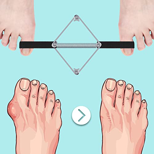 Pilates Toe Stretcher Bunion, Hallux Valgus Big Toe Strap Spacer Tension Buni...
