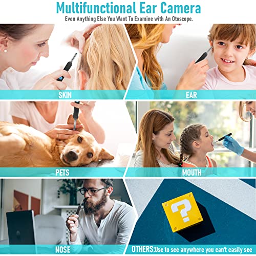 Ear Wax removel Kit Ear Camera and Wax Remover Ear Light Otoscope 2022 Newest...