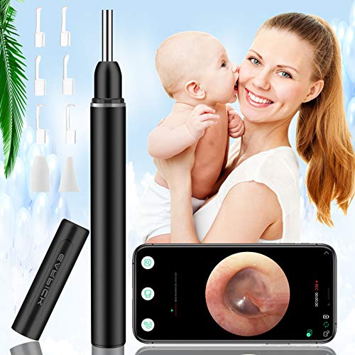 Topicy Ear Wax Removal Tool, Ear Cleaner with Camera, 1080P FHD Ear Wax Remov...
