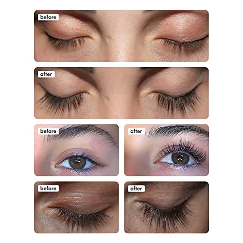 Toplash XL Lash and Brow Booster, Growth Serum with Eyelash and Eyebrow Enhan...
