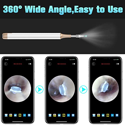 Ear Wax Removal Tool, Wireless Ear Otoscope with Light Ear Wax Removal Kit Cl...