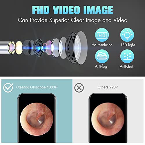 Ear Wax Removal Tool, Wireless Ear Otoscope with Light Ear Wax Removal Kit Cl...
