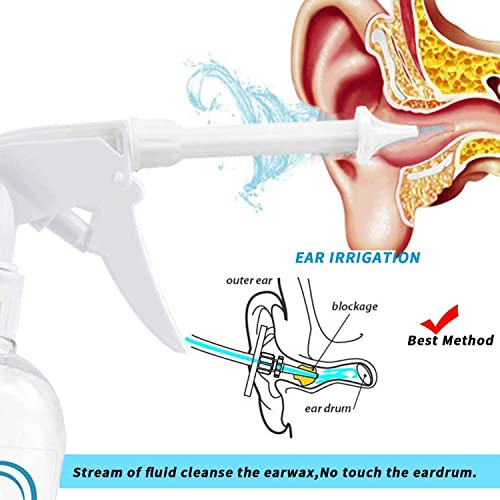 TopQuaFocus Earwax Removal Kit, Electric Earwax Cleaner Earwax Remover Irriga...
