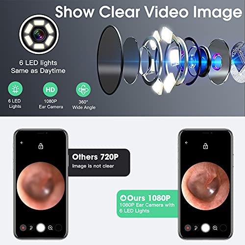 Ear Wax Removal Tool with Camera - Ear Cleaner Kit with Light / 3.5mm Ear End...