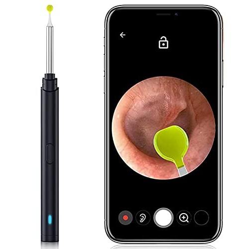 Ear Wax Removal Tool with Camera - Ear Cleaner Kit with Light / 3.5mm Ear End...
