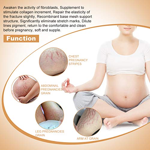 Stretch Mark Cream for Pregnancy Stretch Mark Scar Cream Postpartum Obesity P...