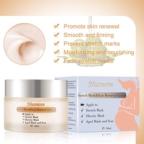 Stretch Mark Cream for Pregnancy Stretch Mark Scar Cream Postpartum Obesity P...