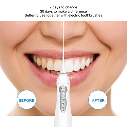 TOVENDOR Electric Water Flosser, Cordless Dental Oral Irrigator - 3 Modes, 3 ...