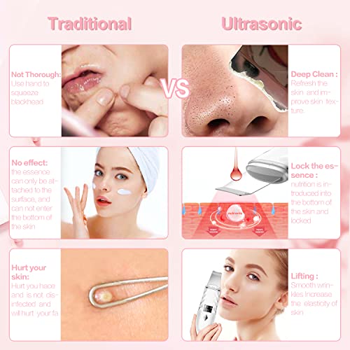 Skin Scrubber,Blackhead Remover Pore Cleaner Skin Scrubber (White)