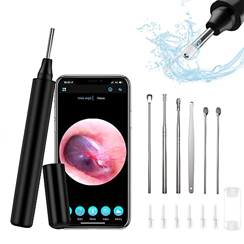 Trandpter Ear Wax Removal, Ear Cleaner Ear Wax Removal Tool, 1296P HD Ear Cam...