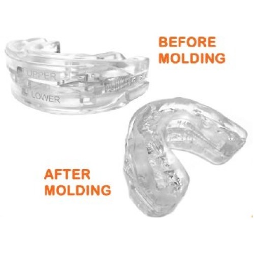 2 x Tranquility Pro 2.0 Adjustable Night Mouthpiece Sleep Mouthguard Bruxism ...