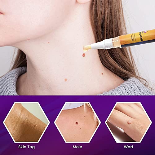 Skin Tag Remover with Advanced Formula: Safe and Effective, Convenient to Use...