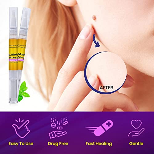 Skin Tag Remover with Advanced Formula: Safe and Effective, Convenient to Use...