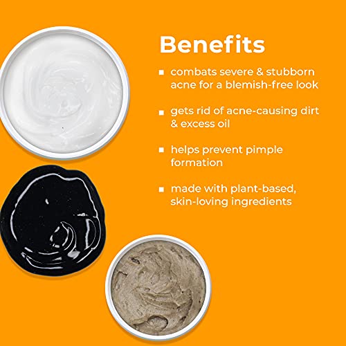 TreeActiv 3-Step Acne Treatment Kit | Charcoal Face Wash, Bentonite Pimple Sp...