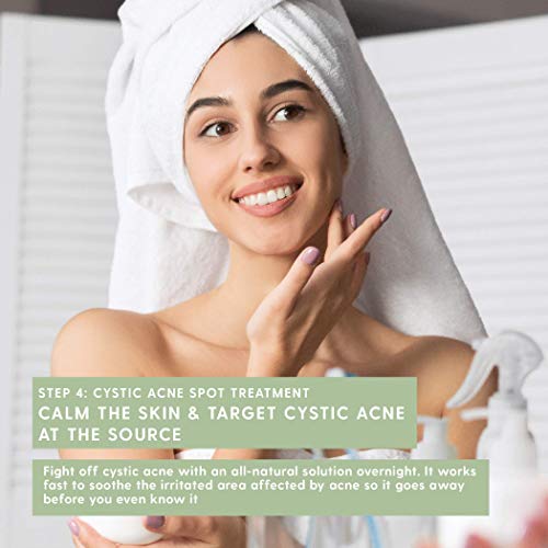 TreeActiv 4-Step Acne Treatment Kit | Sulfur Face Wash Exfoliant, Salicylic A...