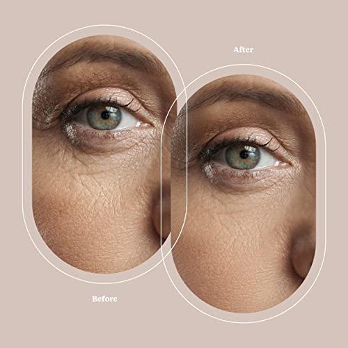 Trophy Skin MicrodermMD - At Home Microdermabrasion Machine - Spa Kit for Wom...