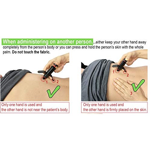 Miracle Acupuncture Trigger Tension Reliever (2 Pack)