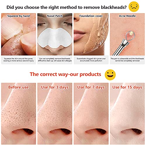 Blackhead Remover Pore Vacuum Skin Care Cleaner Facial Comedone Extractor Ele...
