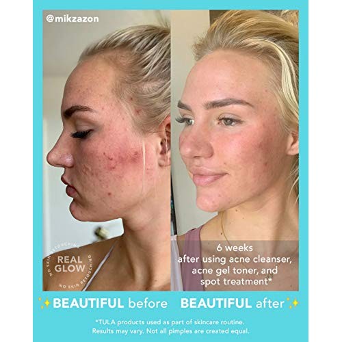 TULA Skin Care Stay Balanced Level 1 Acne Clearing Routine | Effective 3 Piec...