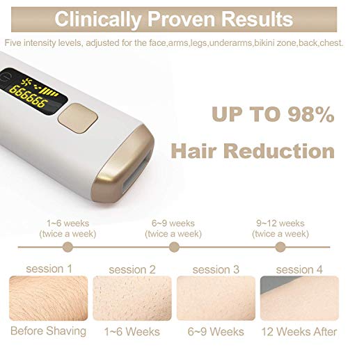 TUMAKOU Painless Permanent Hair Removal Device for Women & Men - 999,999 Flas...