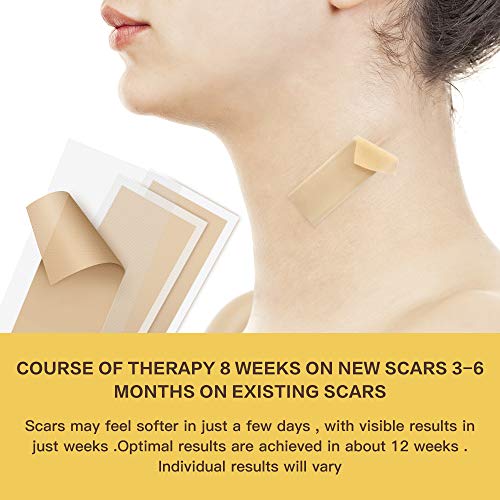 Silicone Scar Sheets, Medical Silicone Scar Tape Easy-Tear & Pain-Free Remova...