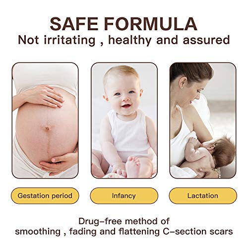 Silicone Scar Sheets, Medical Silicone Scar Tape Easy-Tear & Pain-Free Remova...