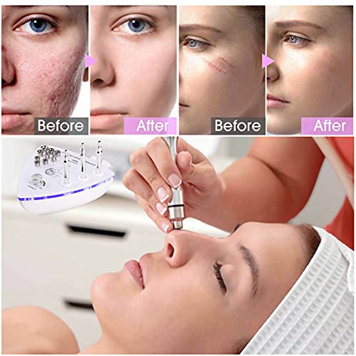 Diamond Microdermabrasion Dermabrasion Machine, Professional Dermabrasion Mac...