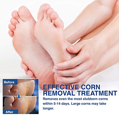 TXL Active Corn Remover Pads, Remove Corns Fast, One Step Pads, Cushioning Pr...