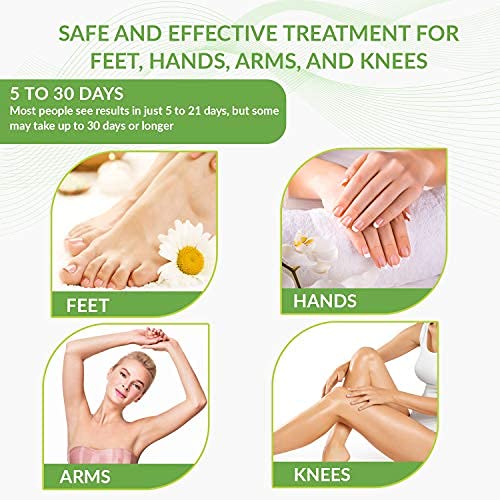 Wart Remover Pads, Remove Plantar and Common Warts | Advanced Natural Formula...