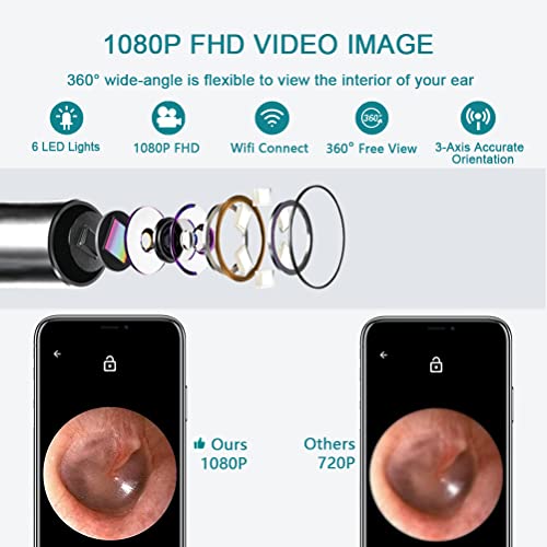 Ear Wax Removal Tool Camera, Ear Cleaner, Earwax Remover Kit 1080P FHD, Ear C...