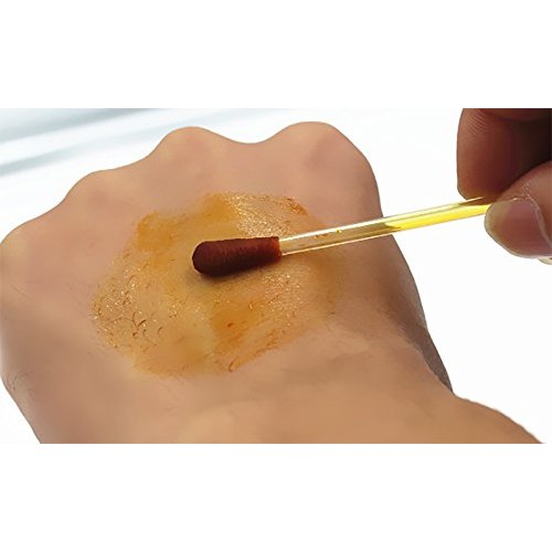 100pcs Disposable Iodine Swab Disinfected Cotton Swab Medical Iodine Cotton S...