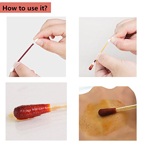 100pcs Disposable Iodine Swab Disinfected Cotton Swab Medical Iodine Cotton S...