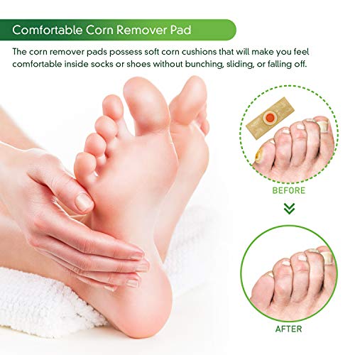 Corn Remover, 24 Corn Remover Pads, Toe Corn and Callus Removal, Corn Treatme...