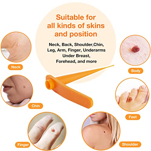 Skin Tag Remover, Standard Skin Tag Removal Kit with 36Pcs Repair Patches for...