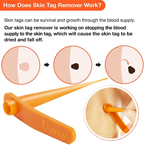 Skin Tag Remover, Standard Skin Tag Removal Kit with 36Pcs Repair Patches for...