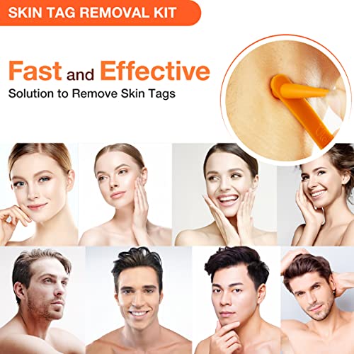 Skin Tag Remover, Standard Skin Tag Removal Kit with 36Pcs Repair Patches for...