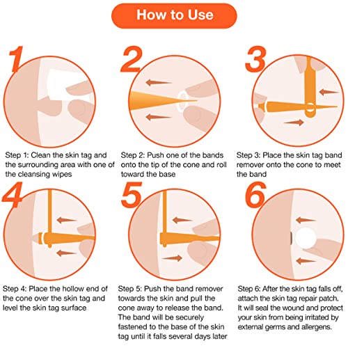 Skin Tag Remover, Standard Skin Tag Removal Kit with 36Pcs Repair Patches for...