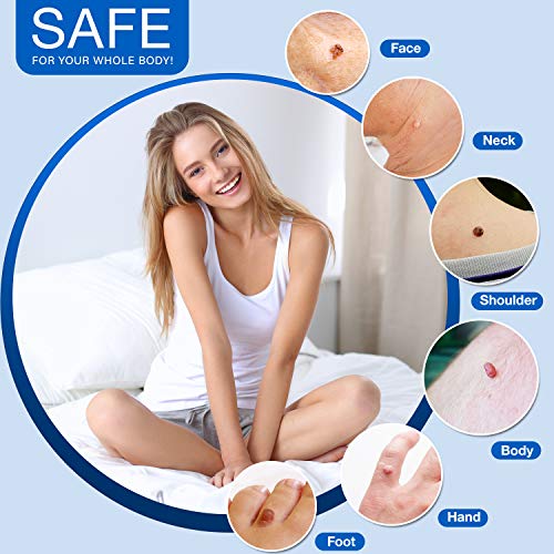 Ulensy Skin Tag Remover, All-Natural Formulation Skin Tag Removal, Fast-Actin...