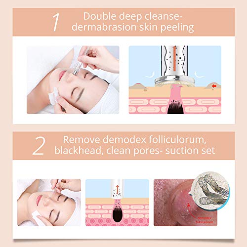 Diamond Microdermabrasion Machine By UNOISETION 3 In 1 Microdermabrasion Derm...