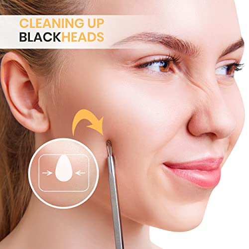 Utopia Care - Professional Blackhead and Blemish Remover - Pimple Comedone Re...
